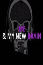Watch Me &amp; My New Brain Putlocker