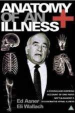 Watch Anatomy of an Illness Putlocker