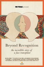 Watch Beyond Recognition: The Incredible Story of a Face Transplant Putlocker